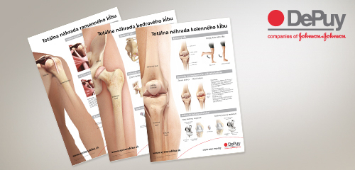 Informační postery pro pacienty (rameno, kyčel, koleno)